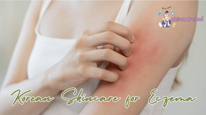 Korean Skincare for Eczema